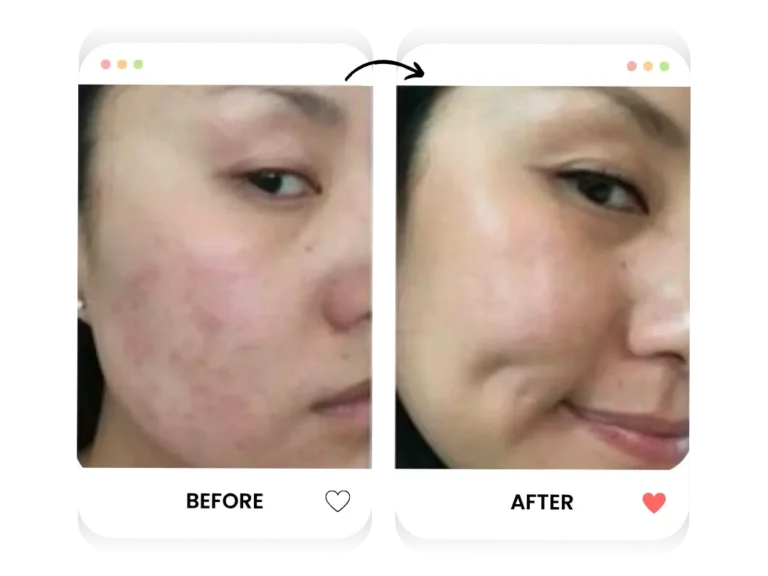 ezgif.com-crop - 2025-07-18T133021.837